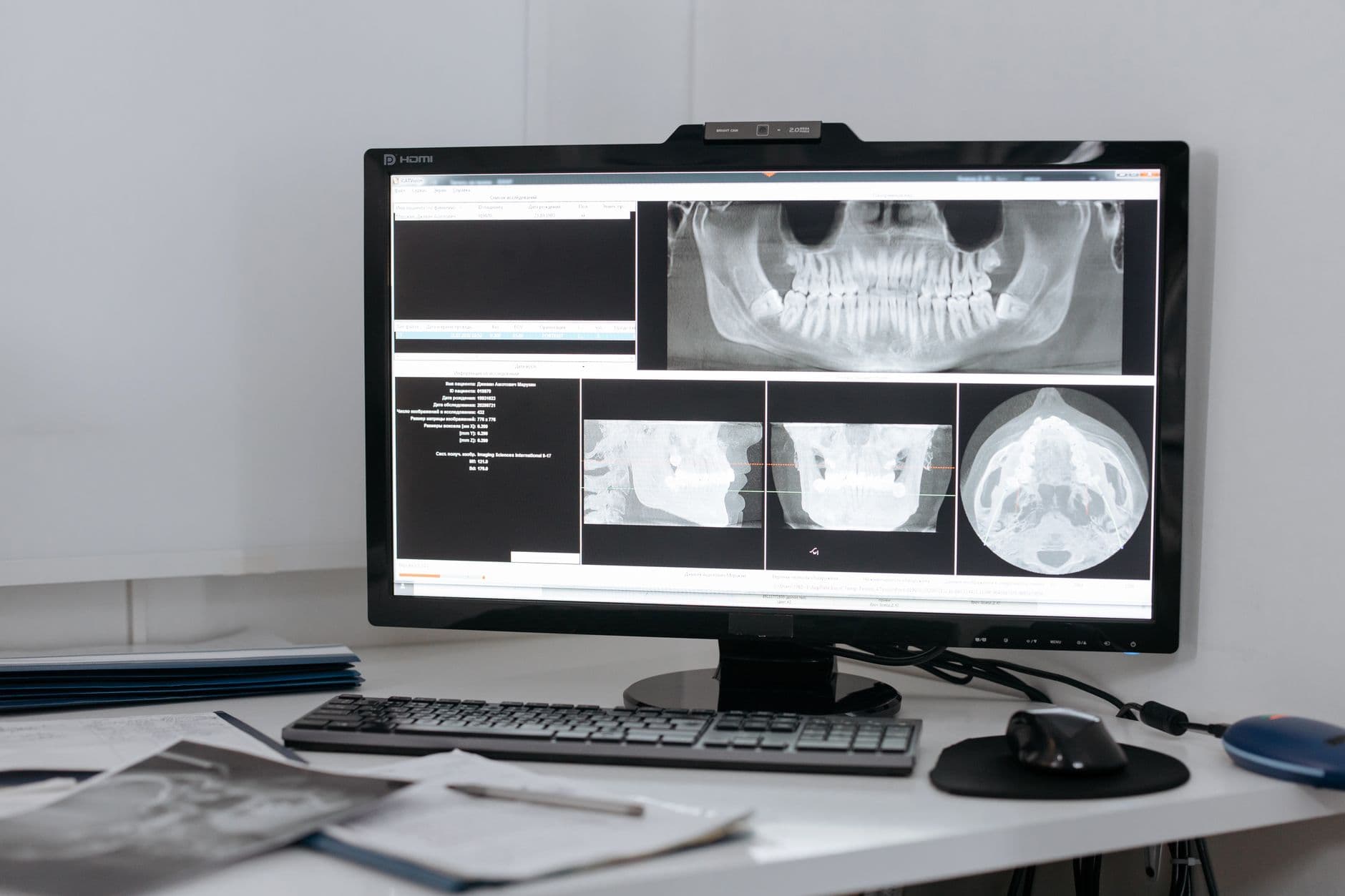 3D dental imaging displayed on a clinic workstation.